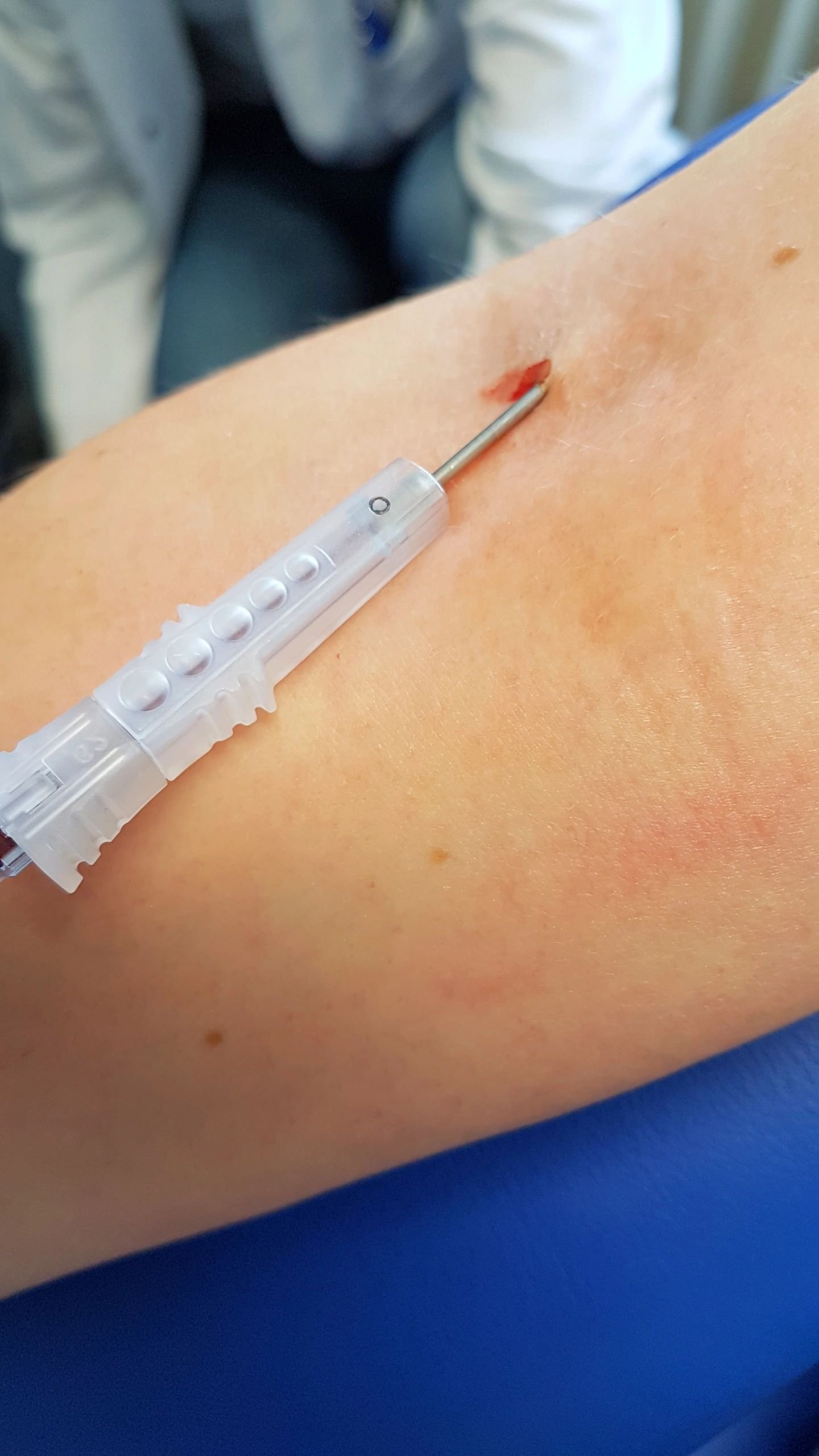 microcannula in use